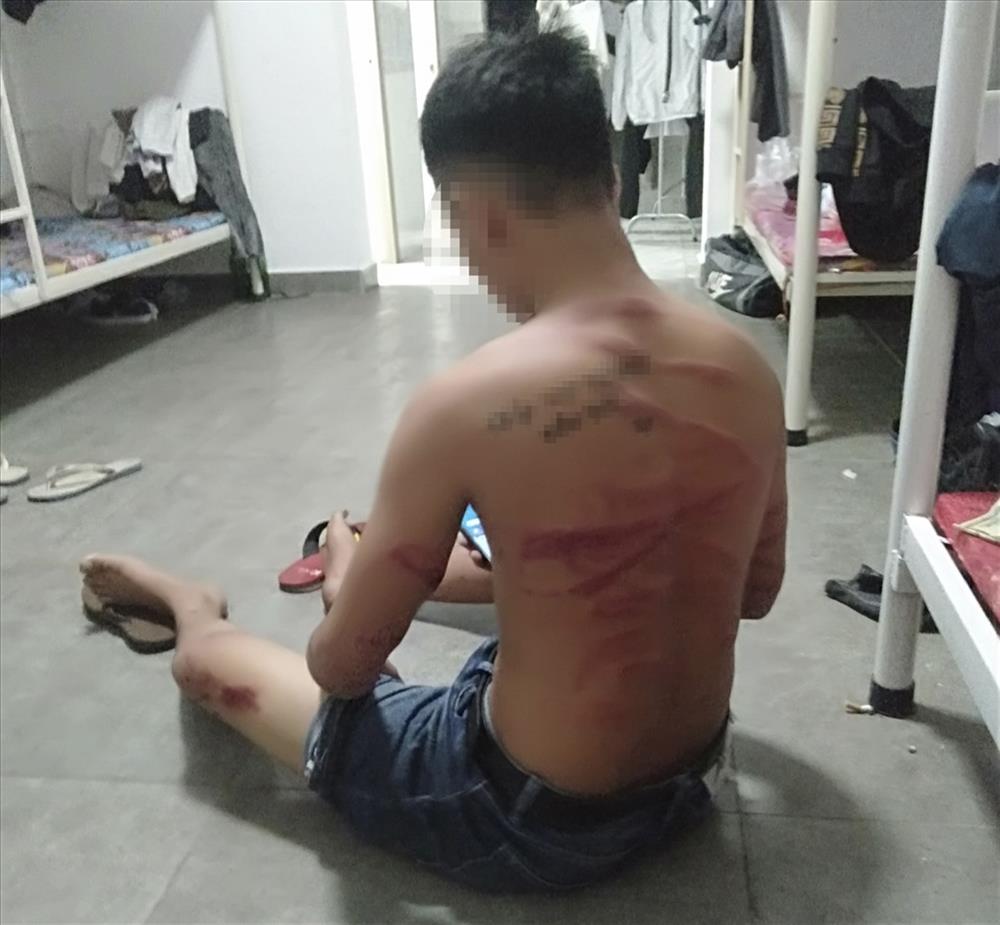 Nạn nhân bỏ trốn bị công ty bắt lại đánh đập, chụp ảnh gửi về cho gia đình mang tiền sang chuộc.